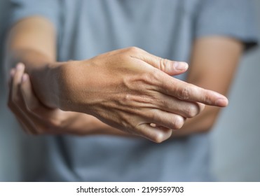 Fingers Rigidity, Hand Muscles Spasm, Or Weakness Of Digits. Closeup View.