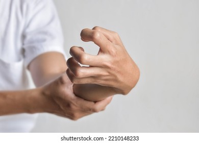 Fingers Rigidity, Hand Muscles Spasm, Or Weakness Of Digits. Closeup View.