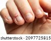 hand nails health