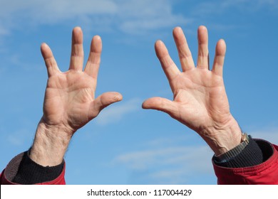 Firework victim missing one ring finger