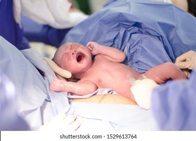 First Photo Of Newborn Baby In Delivery Room