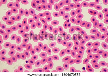 Fish blood cells under the microscope