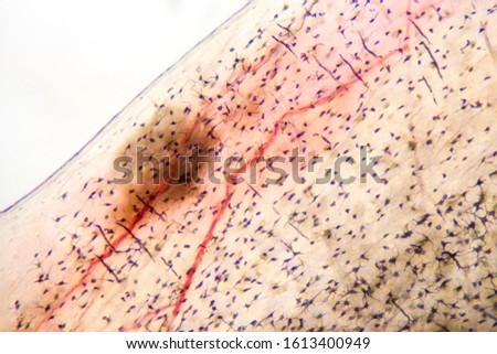 Fish scale fixed on a microscope slide.