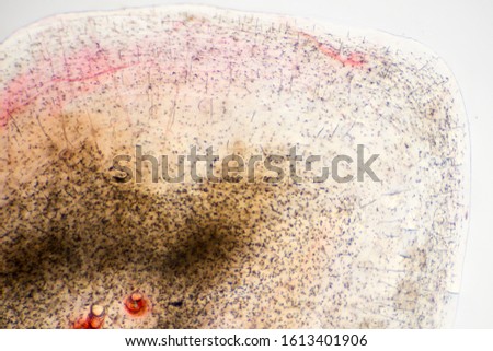 Fish scale fixed on a microscope slide.