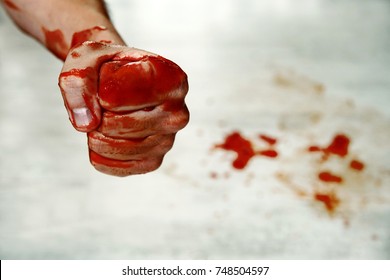 video Bloody fisting Forpahl recommend Ryan ryans pictures