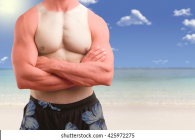 Fit Man Standing Shirtless With His Arms Crossed In A Beach With A Sunburn