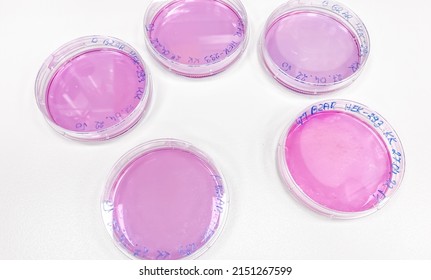 Five Cell Culture Plates With Human Cells Maintained In The Lab. The Cells Can Be Used For Biological Research And Drug Discovery.