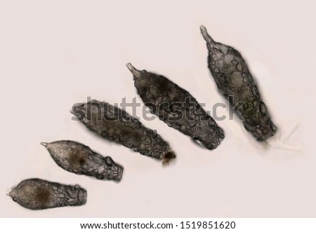 Five Difflugia,  a free-living protist that is enclosed by a sheath of small particles. The cell to the right is producing pseudopodia. Light microscopy, living cells.