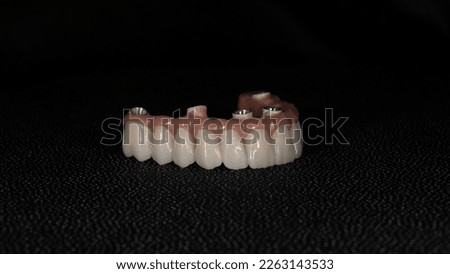 fixed implant teeth all on 4 all on 6