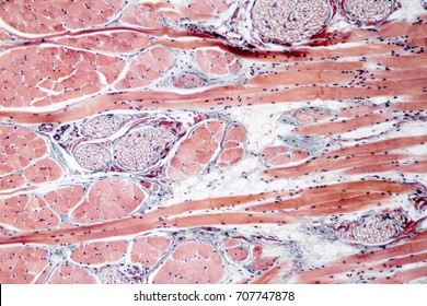 Fixed Slide Cross Section Of Muscle Tissue, 100x Microscope View