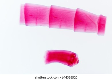Fixed stained slides of tapeworm section