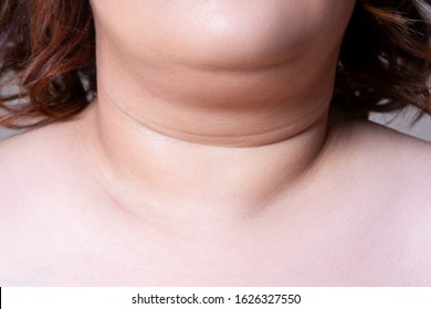 Flabby skin on the neck of an fat woman, female double chin on gray background, wrinkle treatment