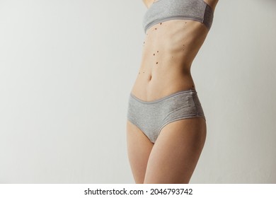 Flat female belly with moles. Beautiful body with birth marks of young woman isolated on gray studio background. Fit, healthy and slim authentical body. Natural beauty, treatment, healthcare