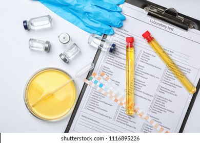 Flat Lay Composition With Laboratory Equipment And Urine Samples On Light Background. Urology Concept