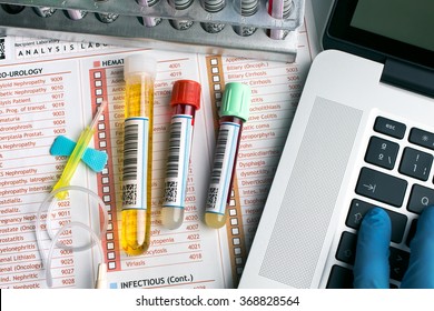 Flat Lay Of Workbench With Tubes Labeled, Laptop And Report For Blood Test / Top View Of A Work Table Of Lab With Test Tubes For Analysis And Computer