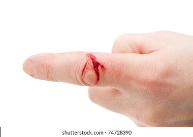 Flesh Wound With  Blood On Male  Finger