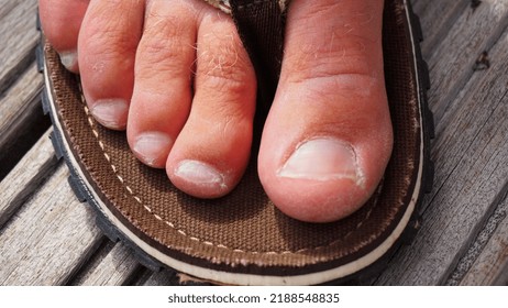 Flip Flop With Man Foot. Summer Shoes With Bare Feet. Flip Flops For Warm Days And Holiday Walks In The Great Outdoors.