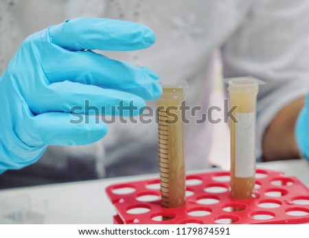 Floatation method  to nematodes egg check in feces by saturated salt solution test tube and cover slide glass