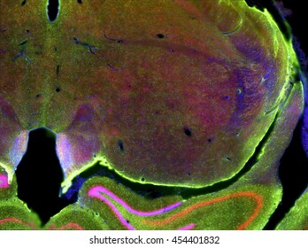 Fluorescence View Of Rat Brain Slice