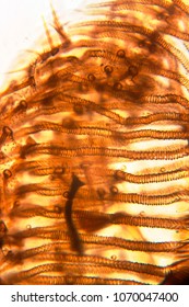 fly under a microscope