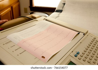 A Focus On An EKG Machine Printing A Readout Of Vitals In A Primary Physicians Office Setting With Blurred Background. 