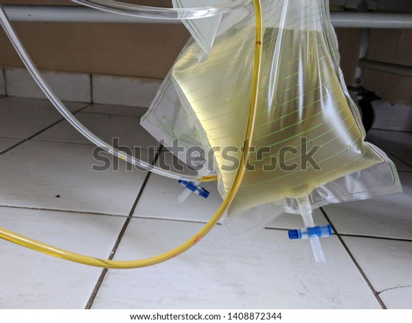 Foley Catheter Thin Sterile Tube Inserted Stock Photo 1408872344 ...