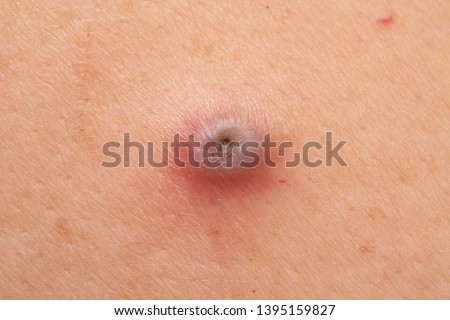 Similar – umbilicus Fluff Navel