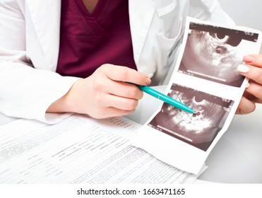 Folliculometry Results. Performing Of Ultrasound Examinations, Growth Of Follicles In The Ovary