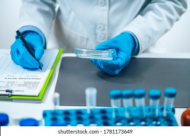 Food Quality Assessment In Microbiology Laboratory, Microbiologist Filling Forms, Following Standard Operating Procedure 