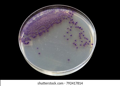 Food safety pathogen E. coli growing on an agar plate.