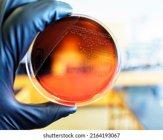 Food Safety Pathogen Listeria Monocytogenes Isolated On PALCAM Agar From A Food Sample.