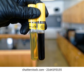 Food Safety Pathogen Listeria Monocytogenes In Fraser Broth, From A Food Sample. The Positive Tube Is Black.