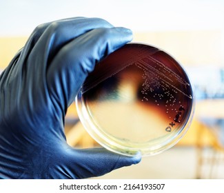 Food Safety Pathogen Listeria Monocytogenes Isolated On Oxford Agar From A Food Sample.