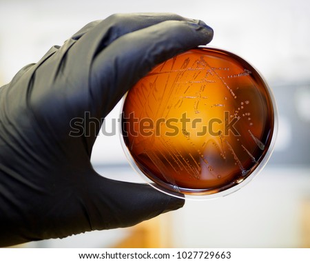 Food safety pathogen Listeria monocytogenes isolated on agar from a food sample.