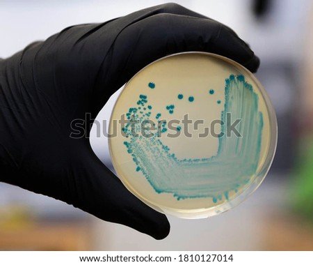 Food safety pathogen Listeria monocytogenes isolated on agar from a food sample