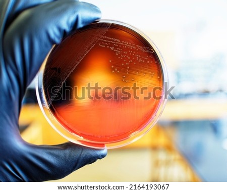 Food safety pathogen Listeria monocytogenes isolated on PALCAM agar from a food sample.