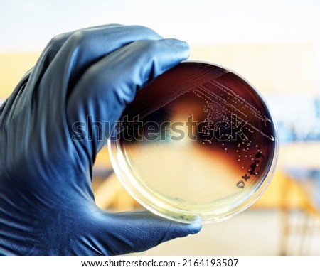 Food safety pathogen Listeria monocytogenes isolated on Oxford agar from a food sample.