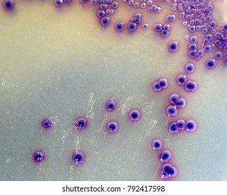 Foos safety pathogen E. coli growing on a agar plate