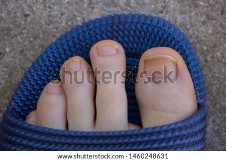 Foot close up, details. Feet with dry skin, yellow nails ,foot top view.