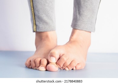 Foot fungus, close-up of an itchy woman scratching her toes with her big toes. - Shutterstock ID 2178840883