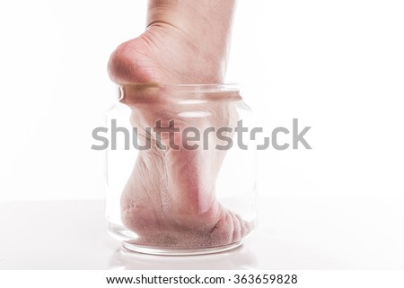 foot girl with a dry and rough skin and calluses on the heel moistened with water from the jar.