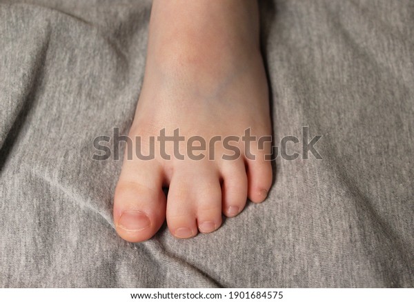 boy feet webshots