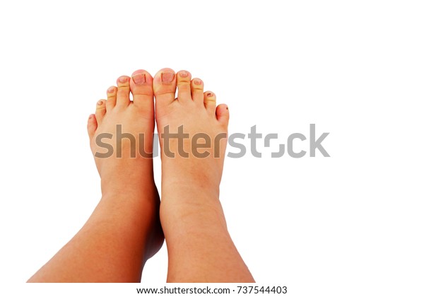 Bbw Teen Feet