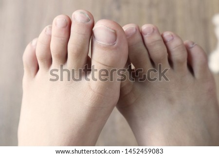 foot  nail skin two toe