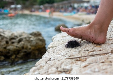 Foot On A Sea Urchin. Human Feet On Sea Urchin At The Beach. Male Foot Steeping On Sea Urchin In Ocean Water