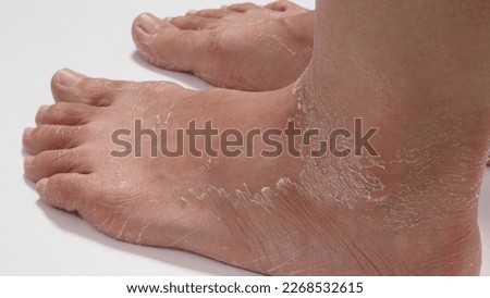 Foot peeling or remove dead skin on white background.