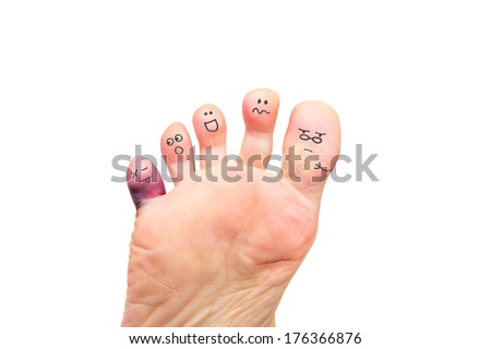 Foot Problems, broken toe and calluses