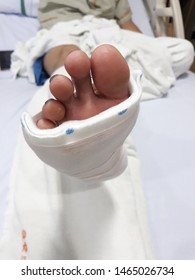 Foot Soft Splint For Treatment Of Injuries From Tendon Inflammation.