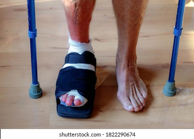 Foot Surgery, Plaster Or Pressure Bandage Wrapped Feet After Operation, Right Side Feet With A Bunion (also Referred To As Hallux Valgus, Hallux Abducto Valgus) Standing With Crutch And Special Shoes.