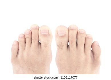 Hairy toe Images, Stock Photos & Vectors  Shutterstock